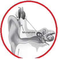 cochlear